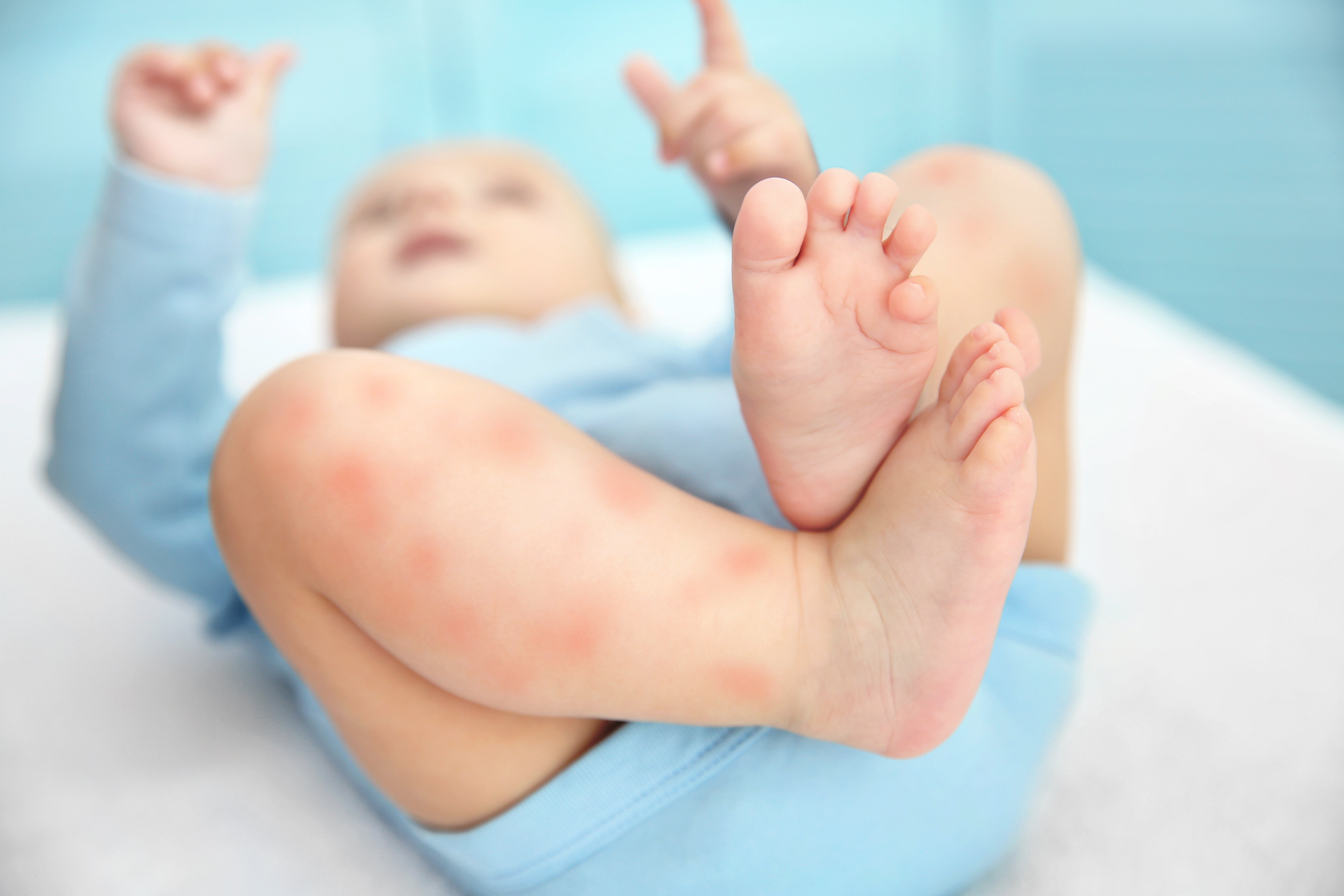 Bébé et Peau atopiques: Symptômes, causes et traitement