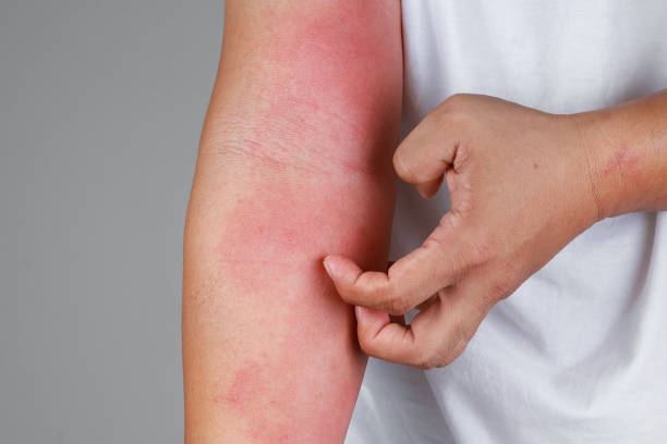 soins anti-irritation