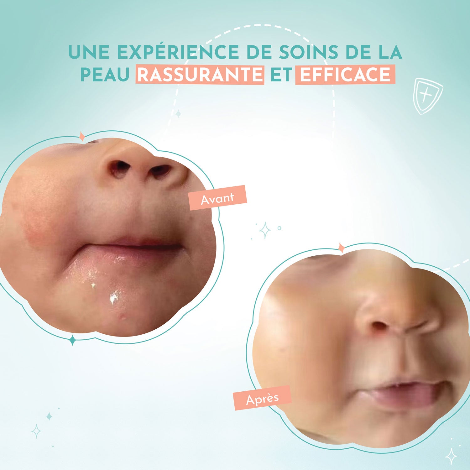 1 RECHARGE CREME DOUTOPIA • Soin Réparateur Peaux très sèches et/ou atopiques