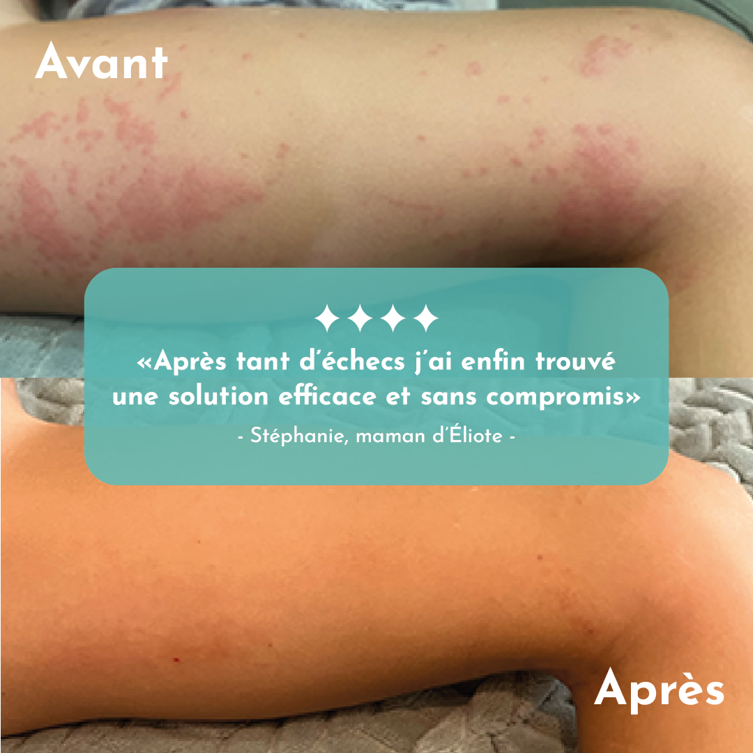 Crème réparatrice et son boitier rechargeable - Doutopia