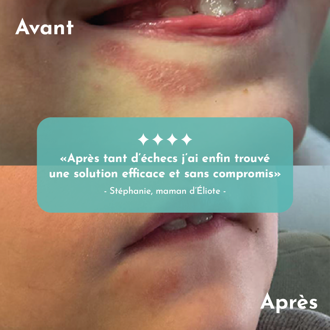 Crème apaisante - recharge - Apaiséa